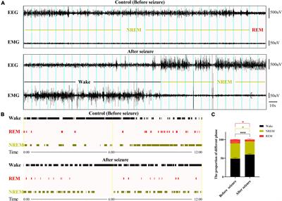 Selective activation of the hypothalamic orexinergic but not melanin-concentrating hormone neurons following pilocarpine-induced seizures in rats